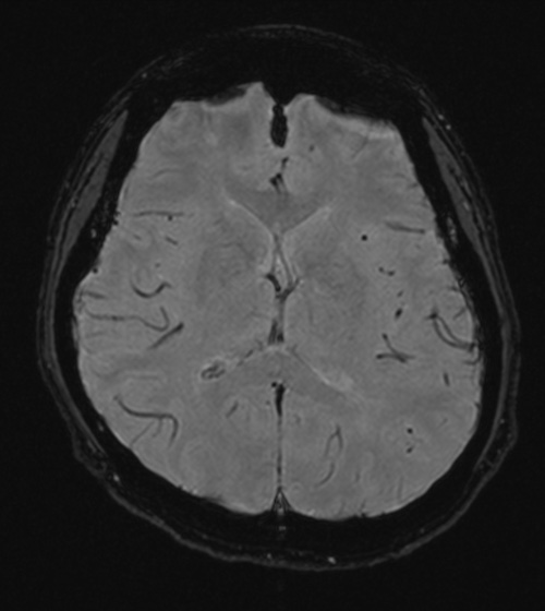 頭部（横断像）