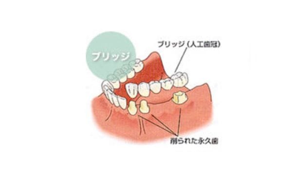 従来の方法