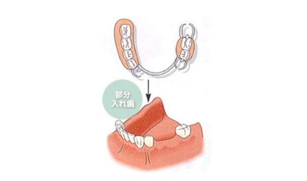 従来の方法