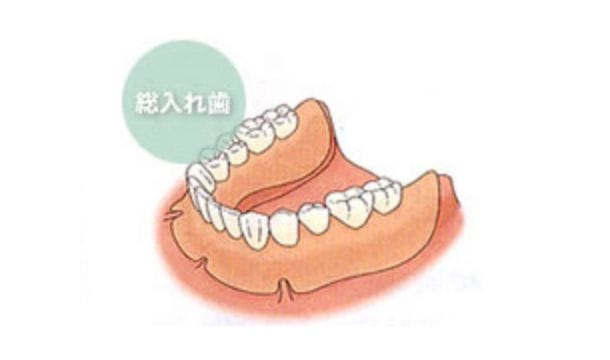 従来の方法