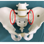 02. おしりやももの付け根が痛いのは―仙腸関節障害かも―