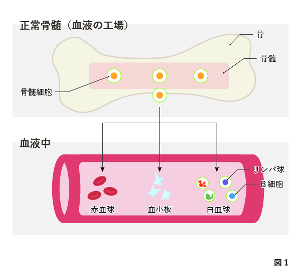 骨髄 末期 腫 性 症状 多発