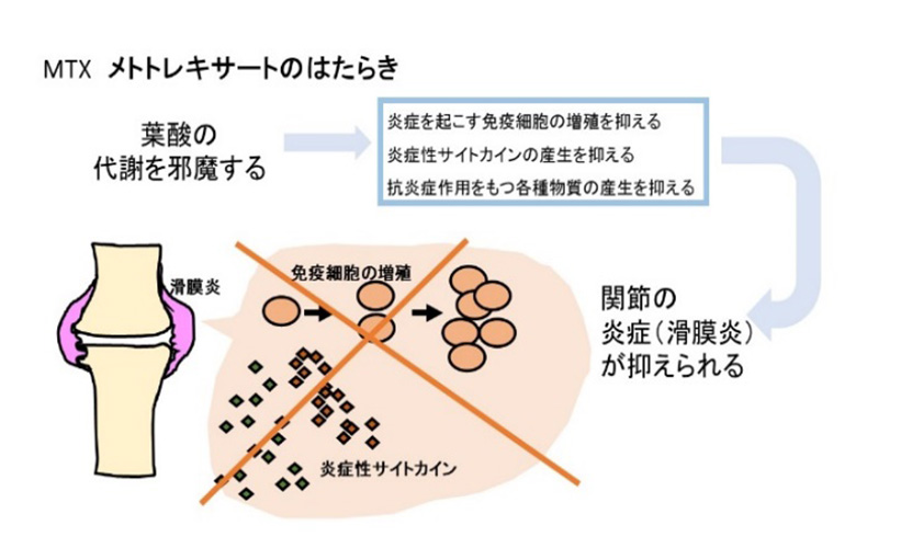 メソトレキサート（リウマトレックス、メトレート）について