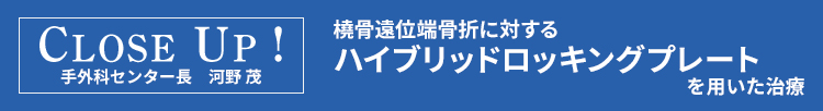 CLOSE UP! 橈骨遠位端骨折に対するハイブリッドロッキングプレートを用いた治療