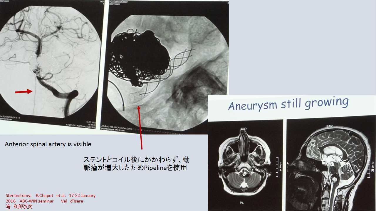 fig11