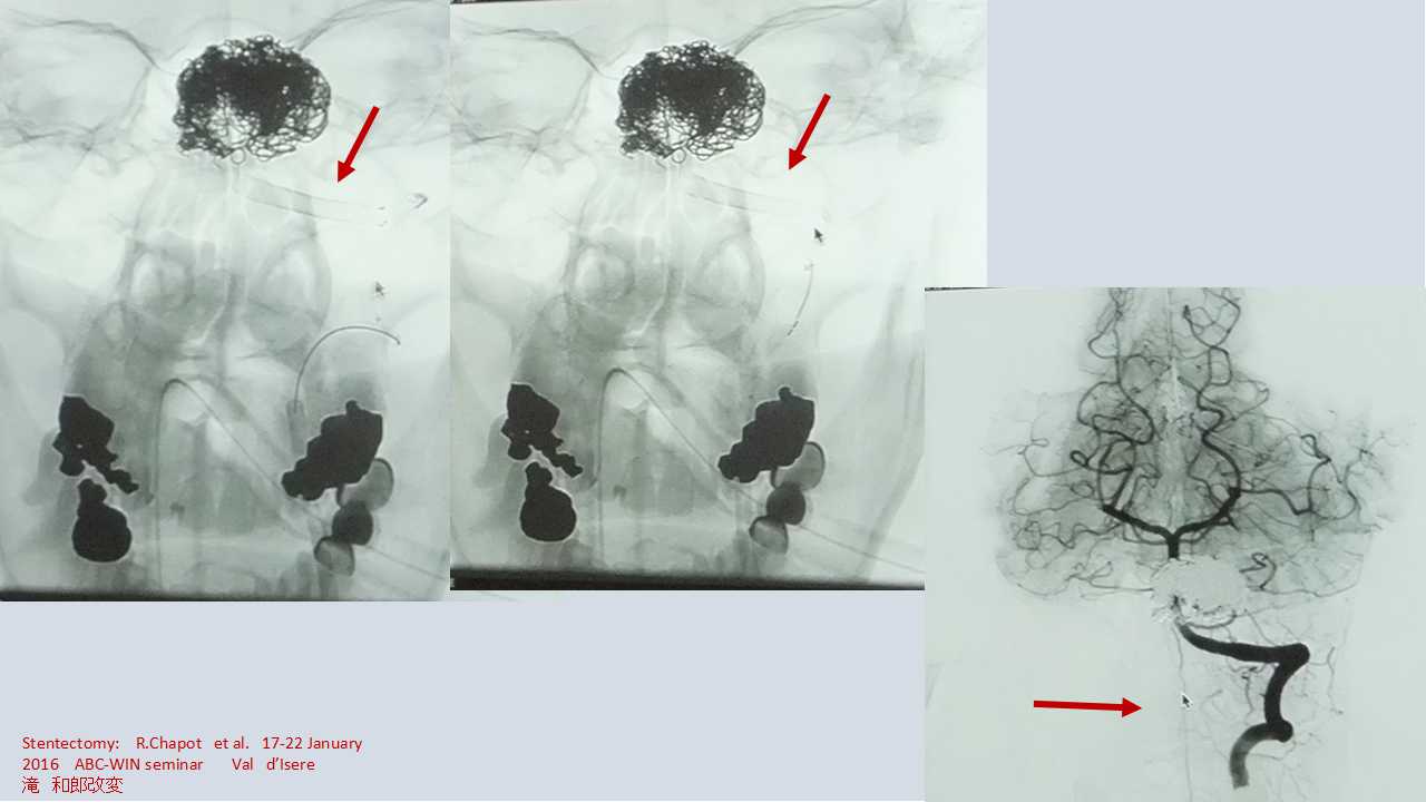 fig13
