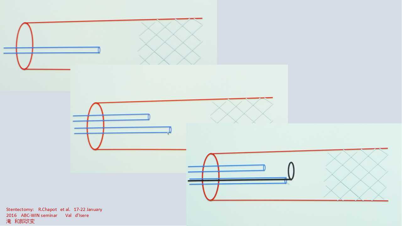 fig15