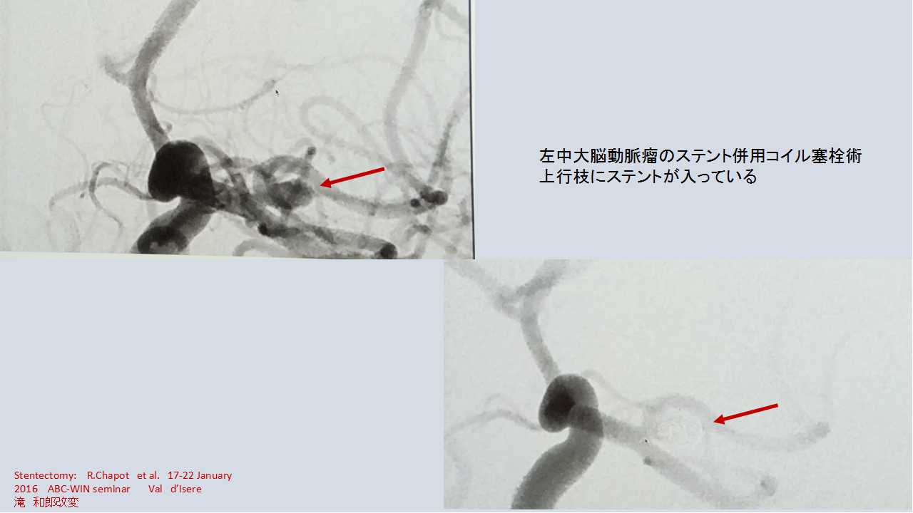 fig17