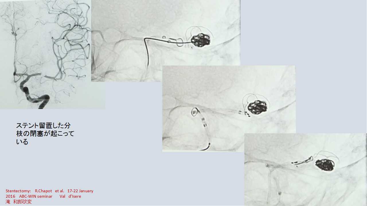 fig18