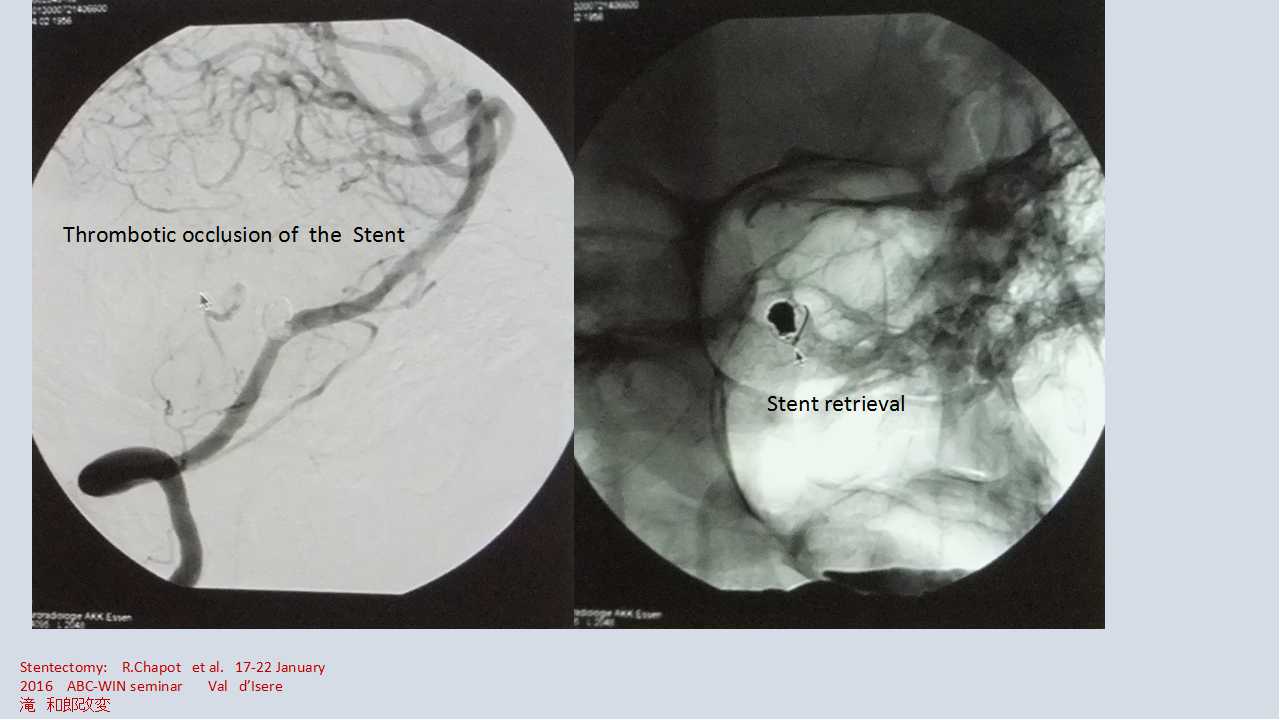 fig02