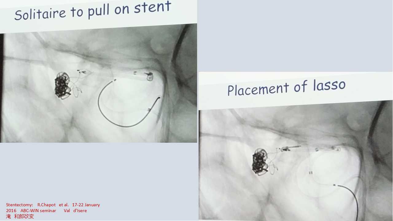 fig21