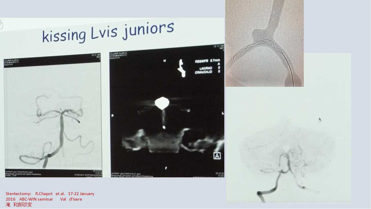 fig05