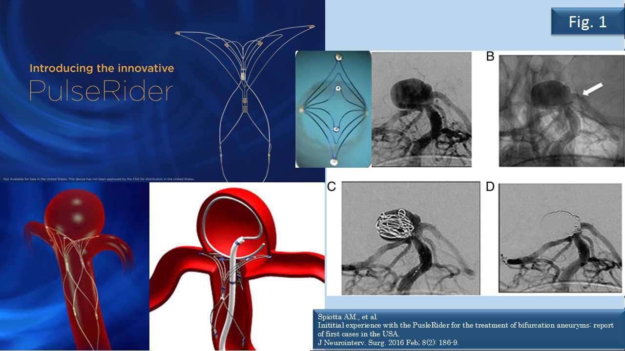 fig01