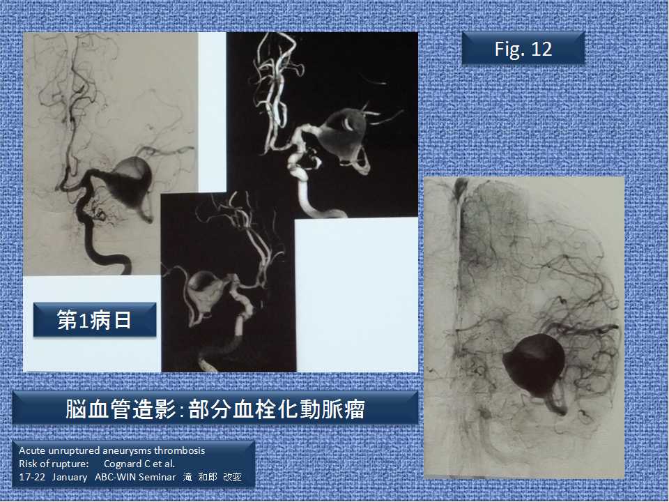 fig12