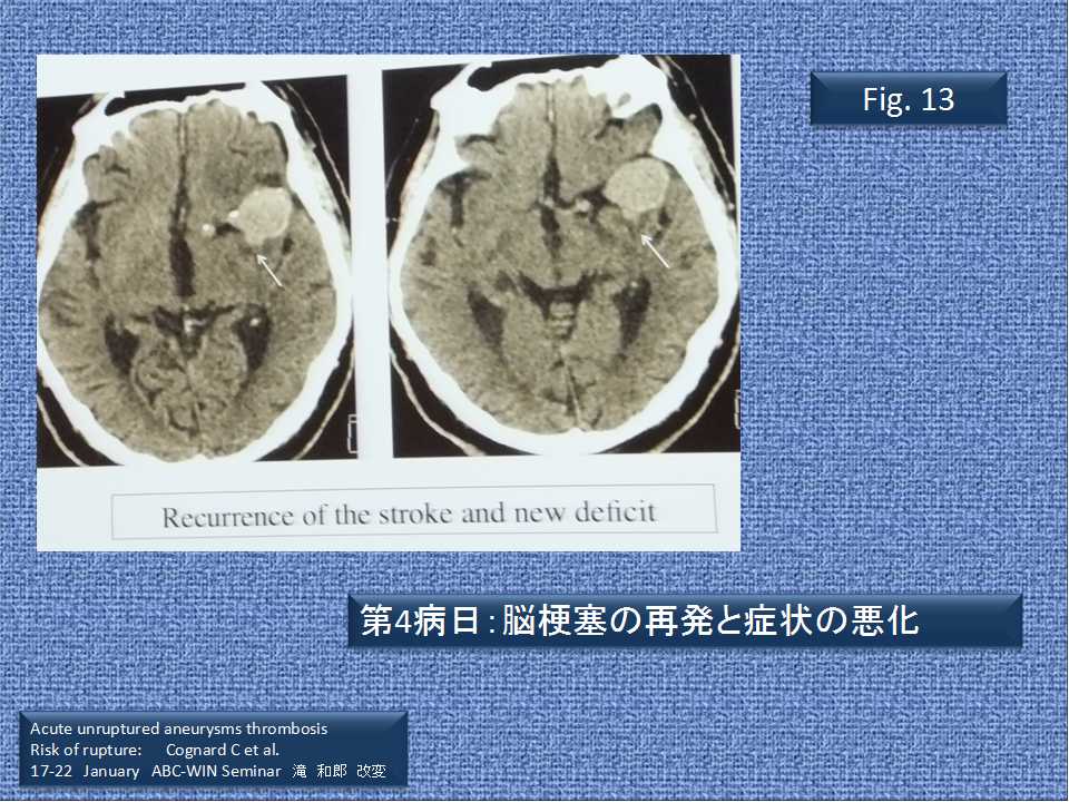 fig13