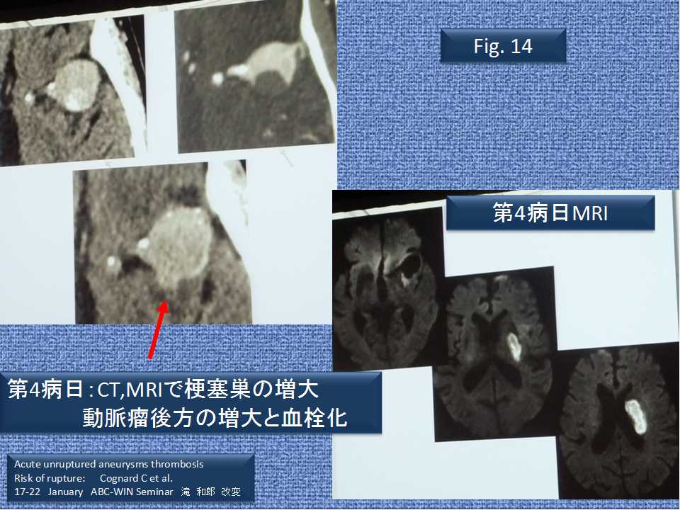 fig14