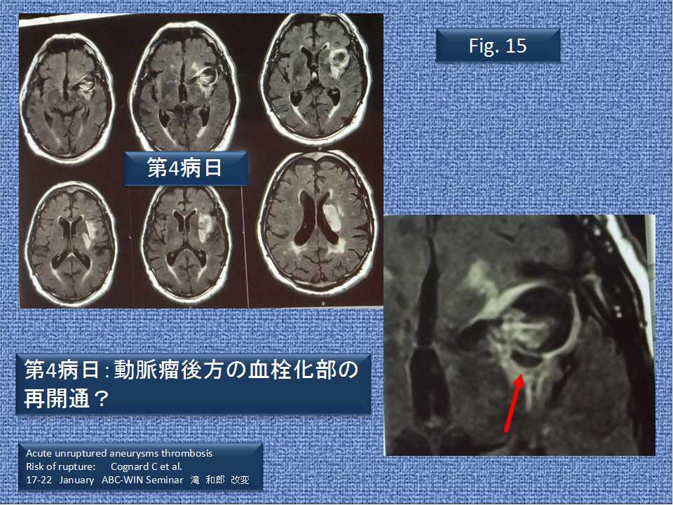 fig15