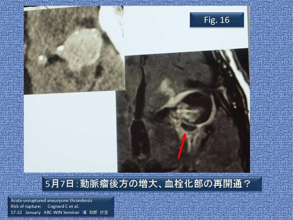 fig16