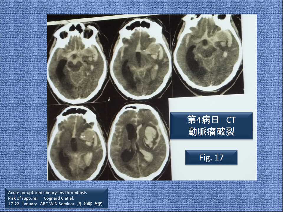 fig17