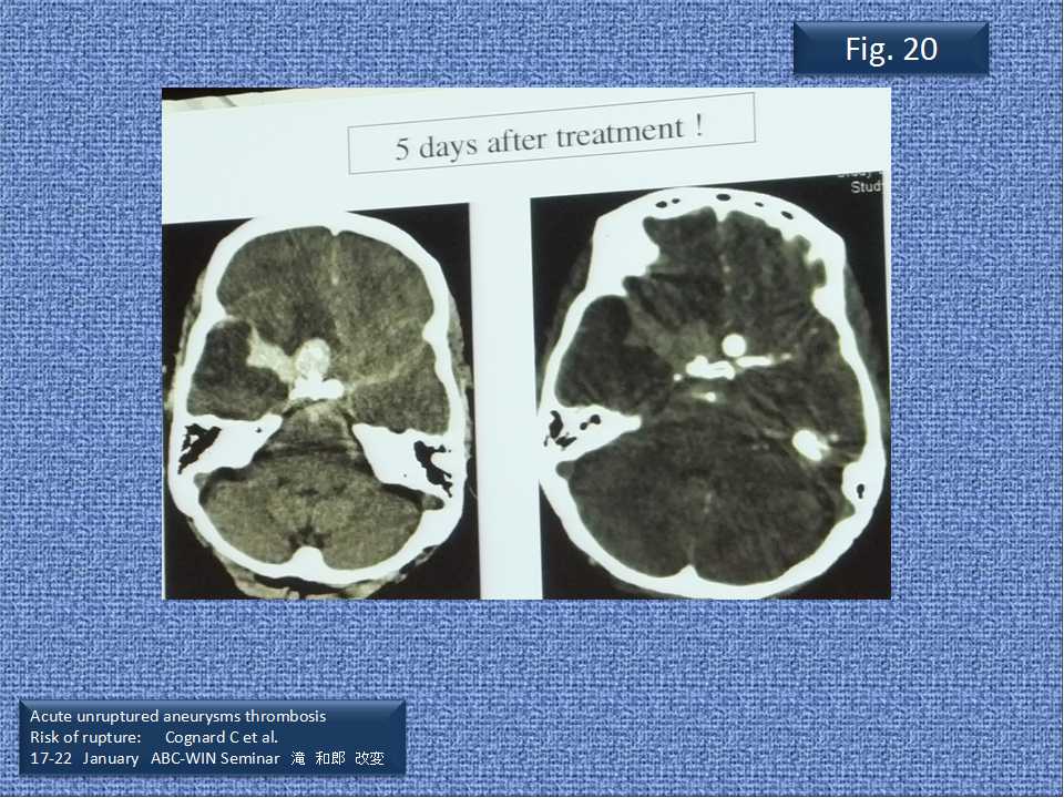 fig20