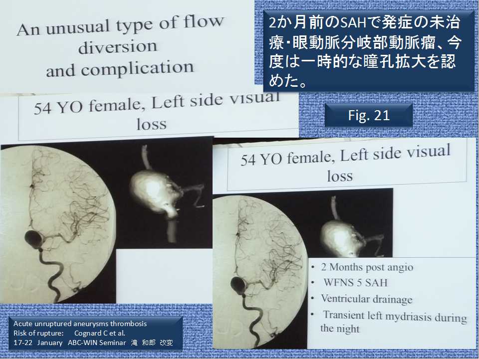 fig21