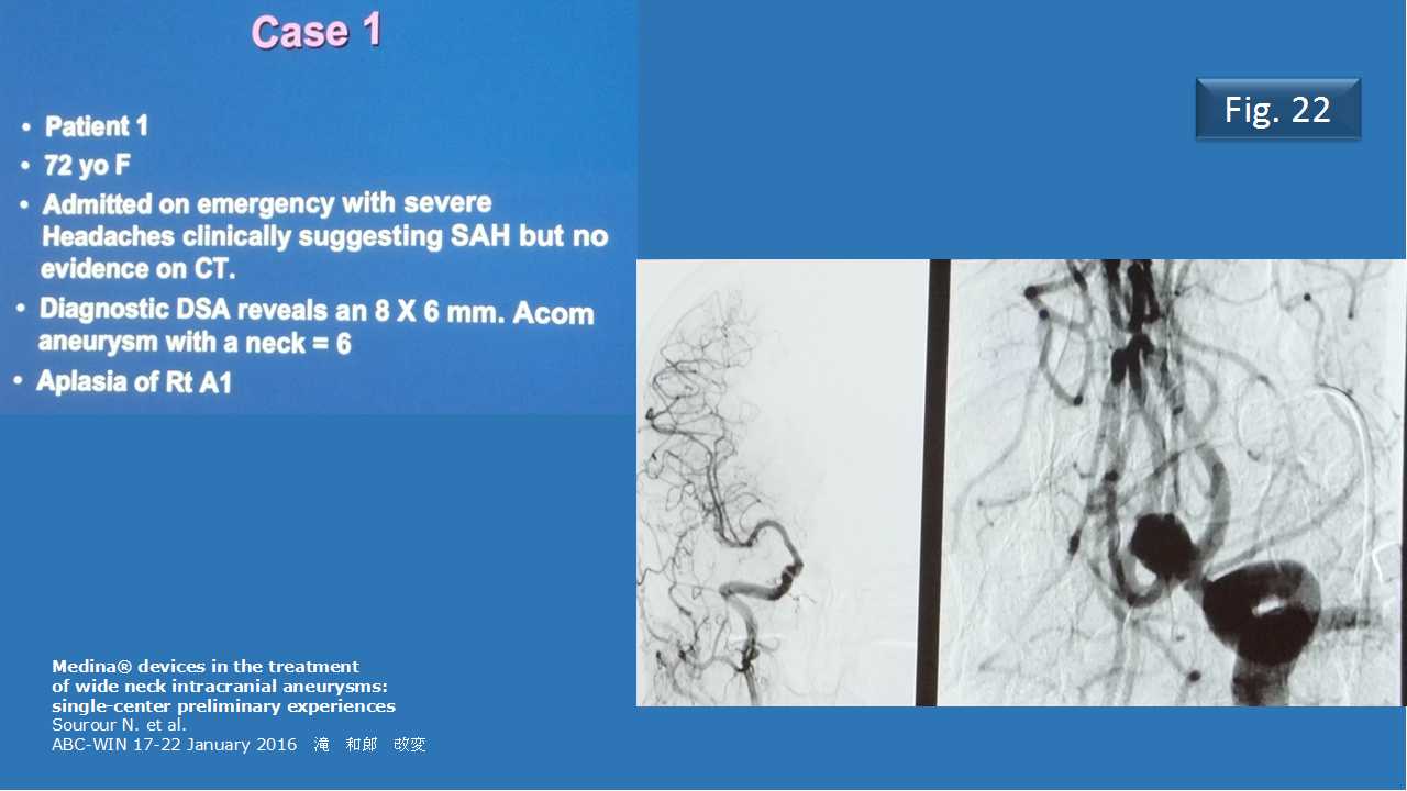 fig22