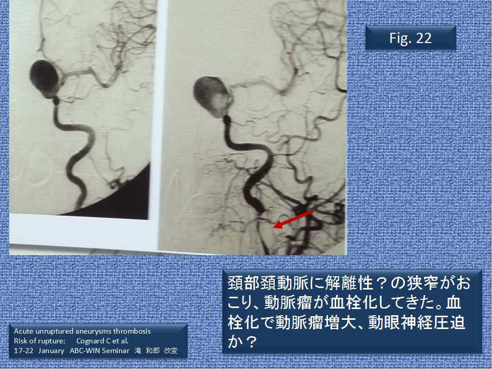 fig22