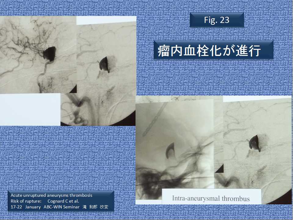 fig23