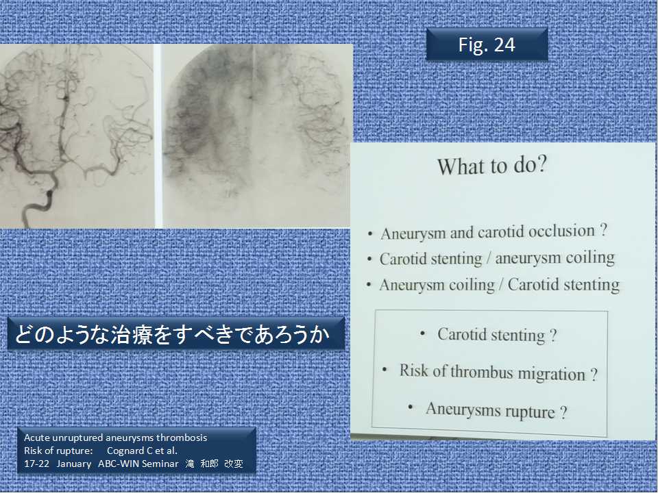 fig24