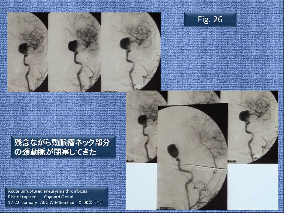 fig26