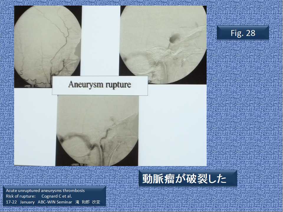 fig28
