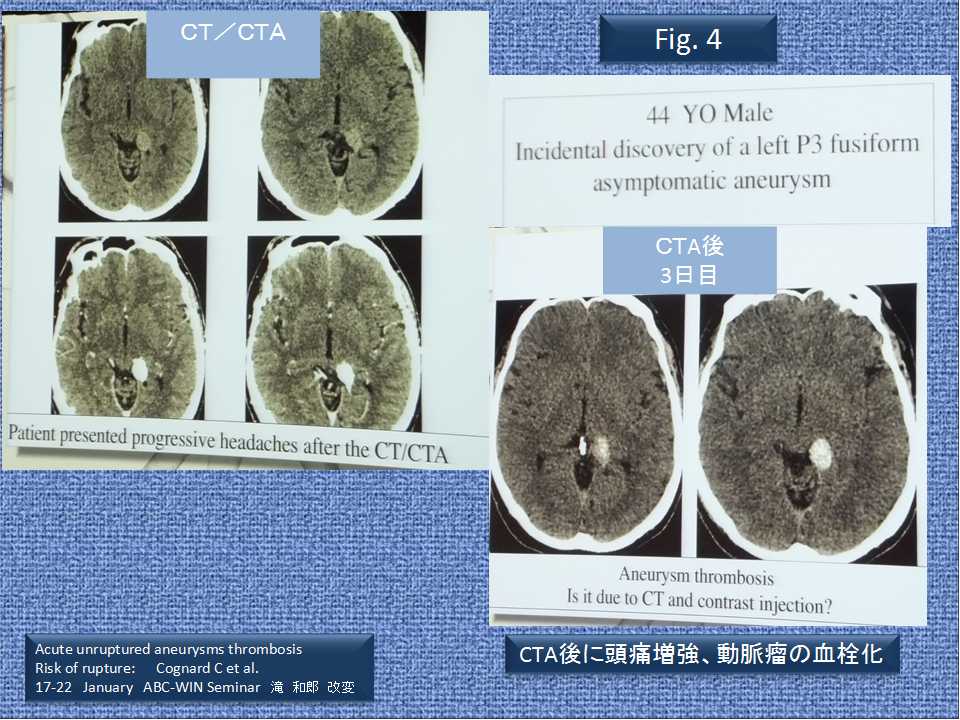 fig04