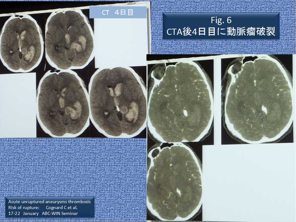 fig06