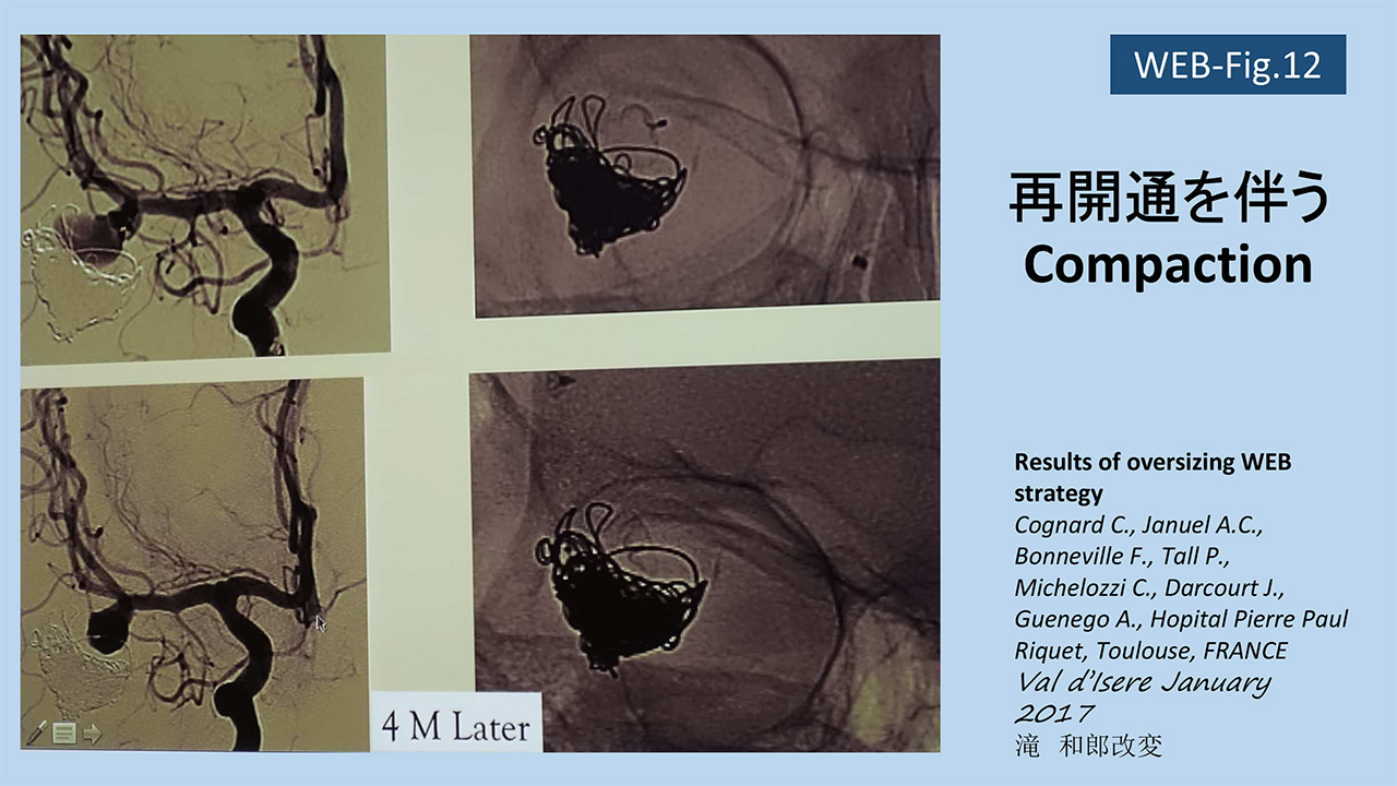 fig12