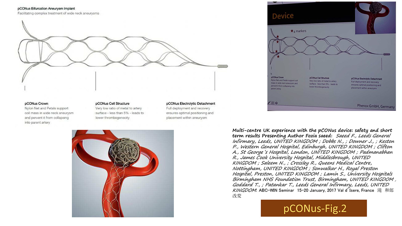 fig02