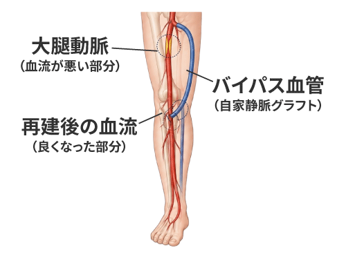 外科手術