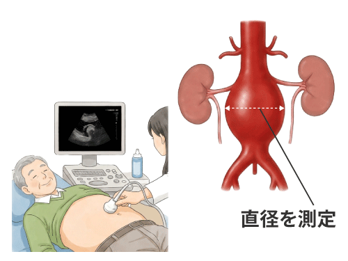 腹部エコー