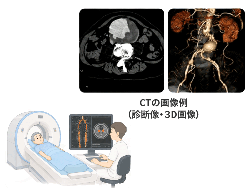 CT検査