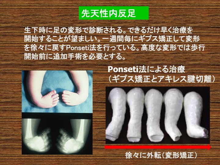 小児運動器 イリザロフ外来 整形外科 診療科 部門紹介 外来受診される方 宇治武田病院 武田病院グループ 小児運動器 イリザロフ外来 整形外科 診療科 部門紹介 外来受診される方 宇治武田病院 武田病院グループ