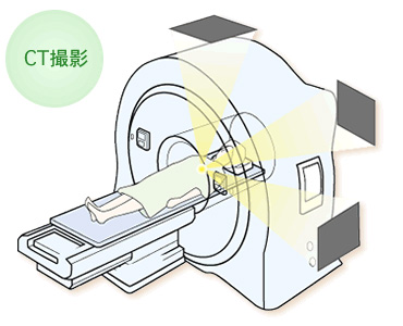 ＣＴ撮影