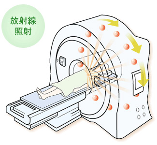 放射線照射